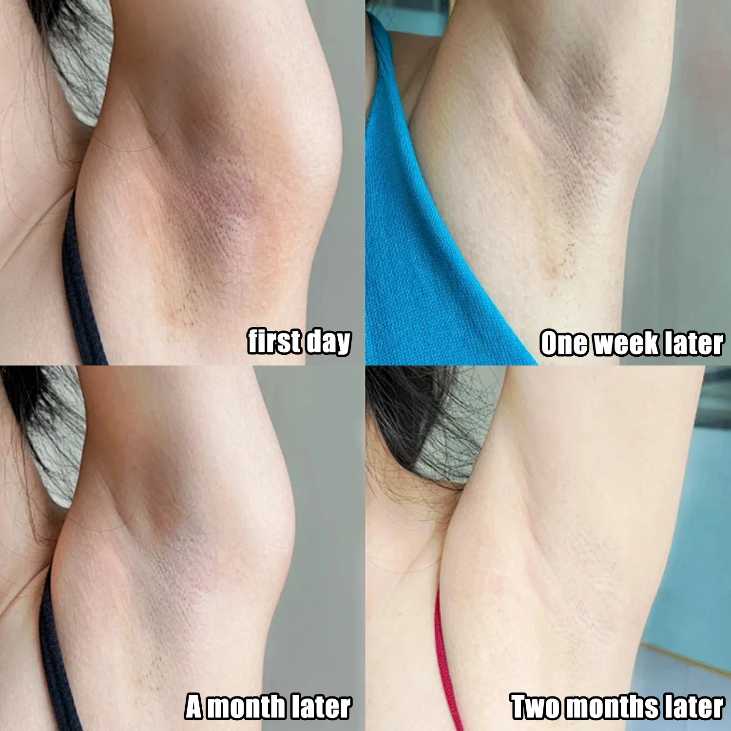 Collagen Underarm Whitening Cr - Skincare Collagen review and price