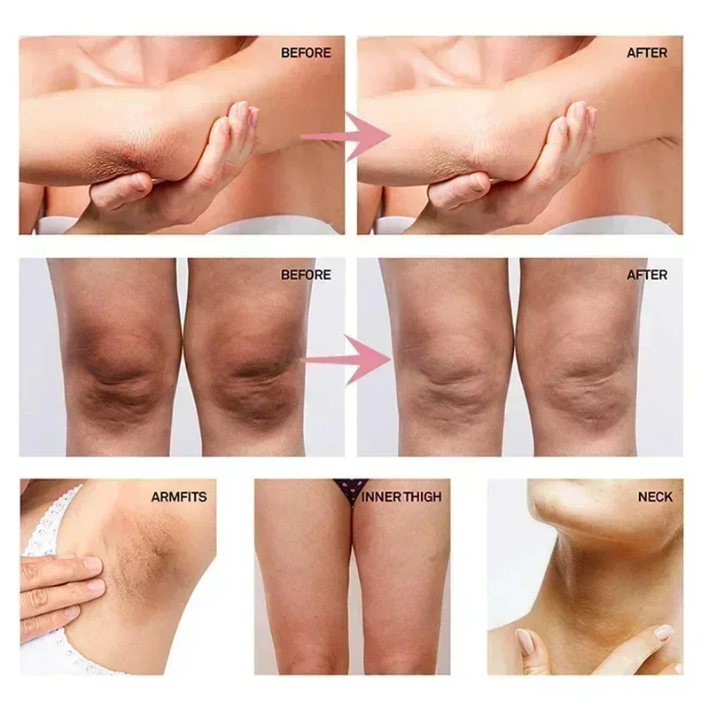 Collagen Underarm Whitening Cr - Skincare Collagen review and price