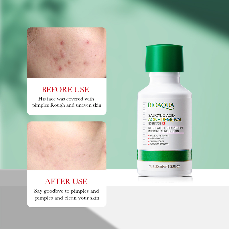 35ml BIOAOUA Salicylic Acid An - Tranexamic Acid Serum review and price