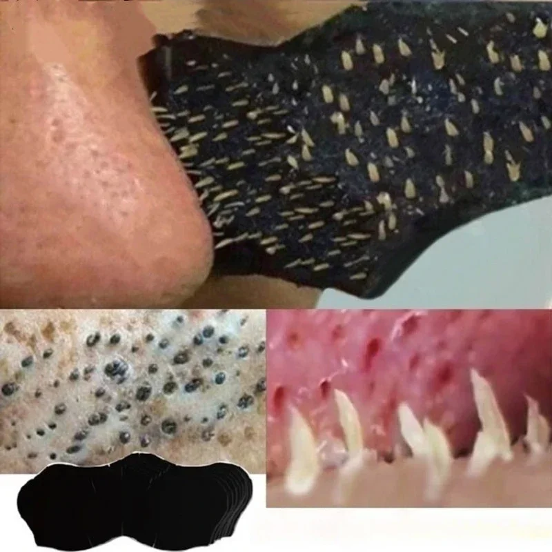 Unisex Blackhead Remove Mask N - Skincare Viral Tiktok review and price